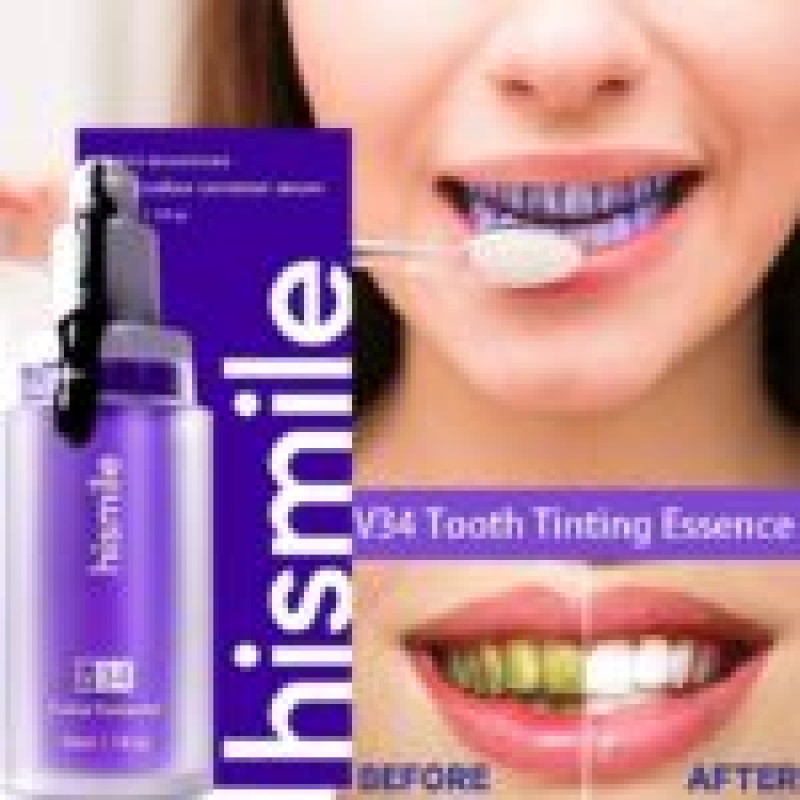 New High smlie teeth whitening