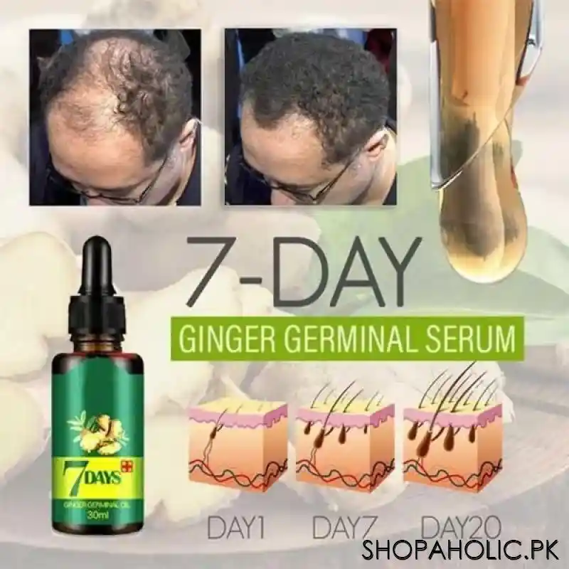 7 Days Ginger Germinal Oil for Hair Regrowth, 30ml